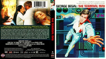 The Terminal Man 1974