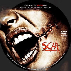 Scar 2007