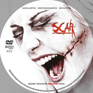 Scar 2007