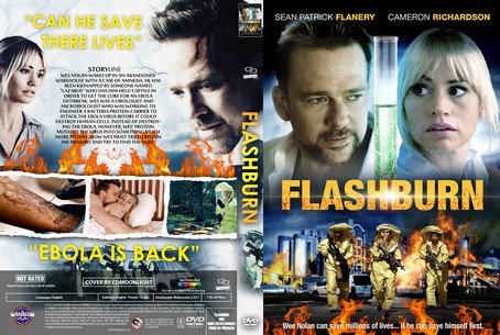 flashburn